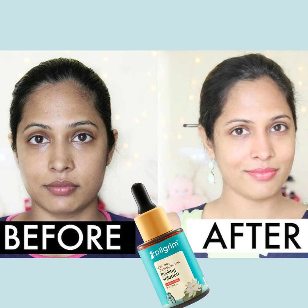 Pilgrim 25% AHA + 2% BHA + 5% PHA Peeling Solution Face Serum for Exfoliation|10 Minutes DeTan Challenge