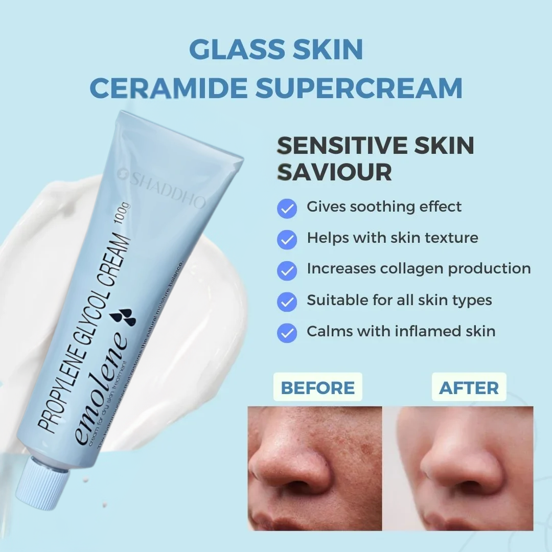 Emolene Cream 100g - Intense Moisturizer for Dry Skin, Smoothens & Helps Fade Marks & Acne Spots